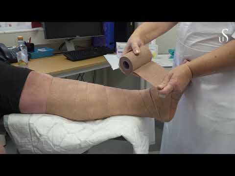 Prosedyrefilm for sykepleiere – Hvordan legge Coban 2, 2-lags kompresjonssystem