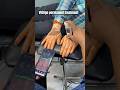 VITILIGO TATTOO COVERUP Vitiligo Permanent Treatment Pigmentoz Process For Vitiligo Vitiligo