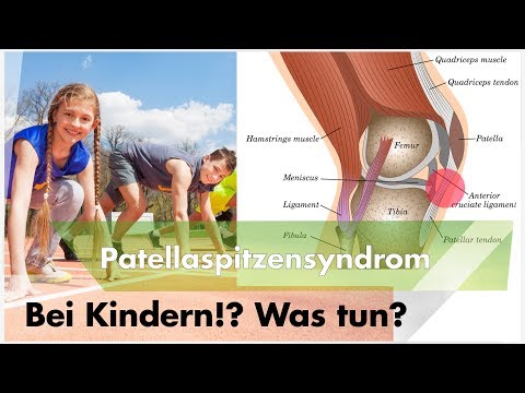 Arthrose des Knie Syndrome Tabletten, die aus dem Gelenkersatz terafleks