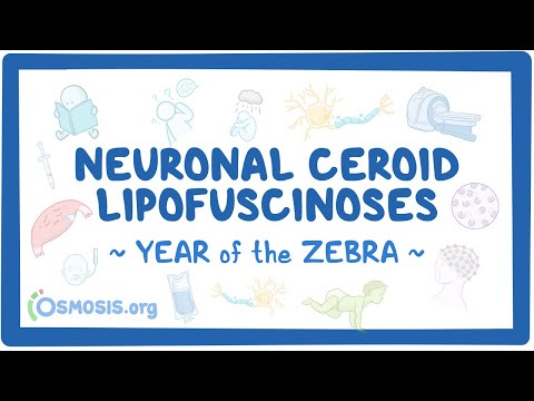 Achalasia Year of the Zebra