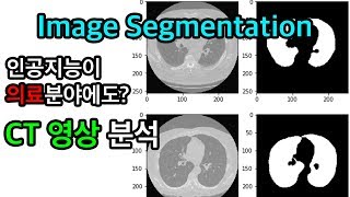 CT 영상에서 폐 영역만 뽑아보자! - Python, Deep Learning
