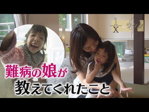 スミス・レムリ・オピッツ症候群