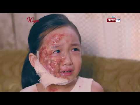 Batang sikat sa kanilang lugar, bilang nasunog ang mukha?! | Wagas