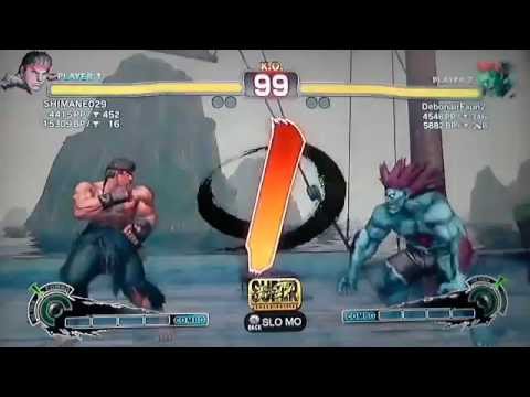 SHIMANE029 [ry] vs [bl]