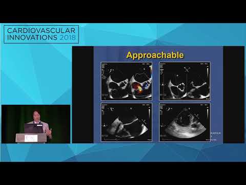 CVI2018 Session: MitraClip feasibility experience - Paul Sorajja, MD