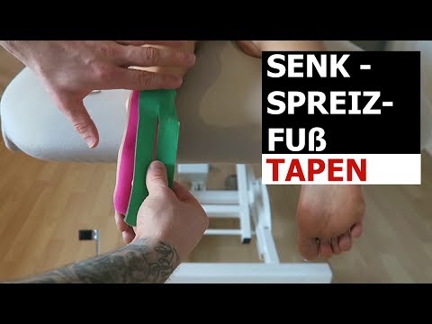 Kinesiology Taping Anlage Plattfuß Senk-Spreiz-Fuß