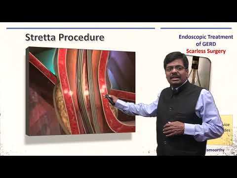 10  Endotherapy For GERD