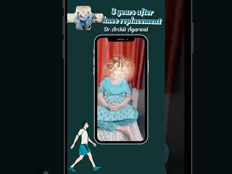  Life 3 years after total knee replacement | Dr. Archit Agarwal