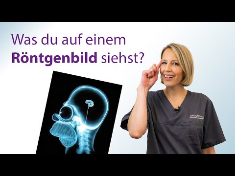 Was du auf einem Röntgenbild siehst