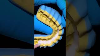 Smile design mock up #dentist #mockup #dentistry