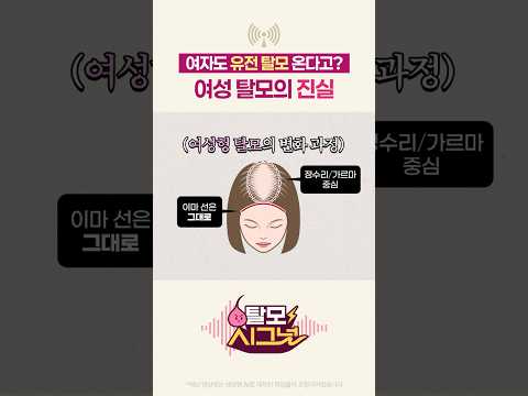 여자도 유전 탈모 올 수 있다고?