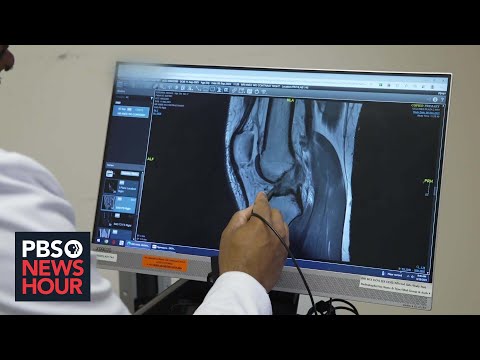 Why ACL injuries are more common in female athletes than male counterparts