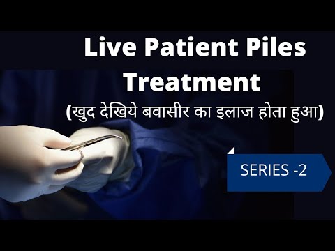 How the Patient of Piles is Treated? प्रत्यक्ष देखे कैसे बवासीर के रोगी का इलाज होता है ? Series 2