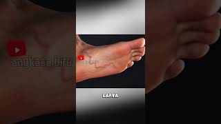 Download lagu Worms Nest in Your Feet! Here Are the Horrifying Facts About Hookworms! #educationalfacts #hookwo... mp3