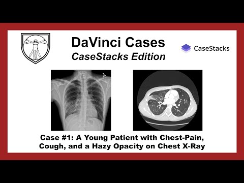 Chest X-Ray and Chest CT Interpretation