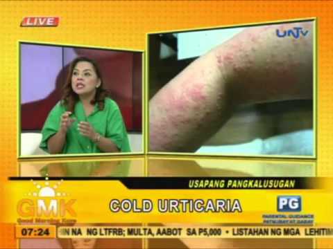 Bagong paggamot para sa mga halamang-singaw Kung magkano ang gastos at Lotseril Batrafen