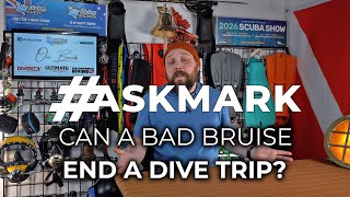 Can a Bad Bruise End Your Dive Trip? #askmark