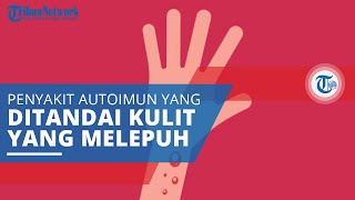Pemfigoid Bulosa, Penyakit Autoimun Ditandai dengan Timbulnya Lepuhan yang Besar dan Bergaris
