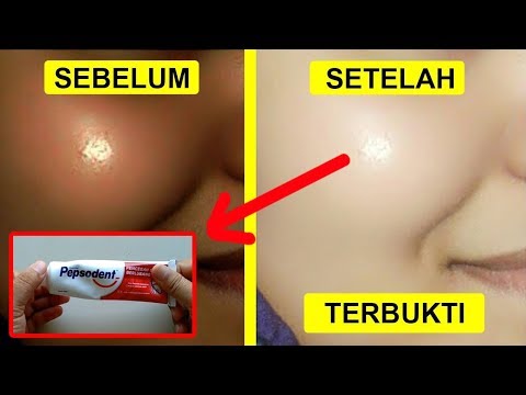 download lagu mp3 mp4 Tips Sederhana Memutihkan Wajah, download lagu Tips Sederhana Memutihkan Wajah gratis, unduh video klip Tips Sederhana Memutihkan Wajah