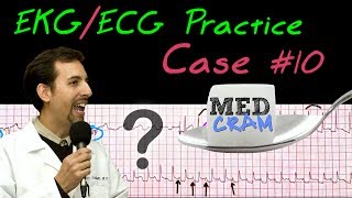 EKG / ECG Practice Strip Interpretation Explained Clearly - Case 10