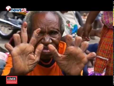 परिवारका मुखियाको मृत्युमा औला काट्नुपर्नेे अनौठौको परम्परा- NEWS24 TV