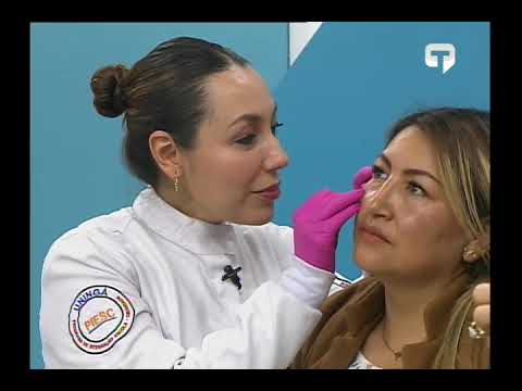 ¿Cómo aplicar hilos de bioestimulación?