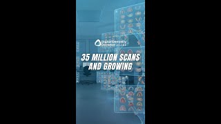 35 Million Scans and Growing - The iOS Revolution