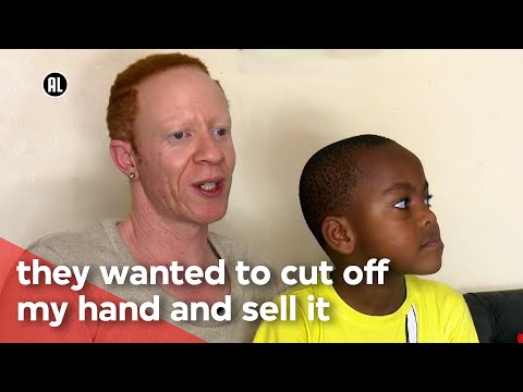 Albino in Kenya | VPRO Metropolis