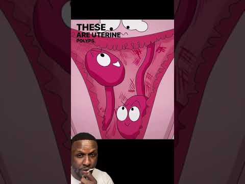 Removing Uterine POLYPS | Doctor Reacts | Animation #shorts