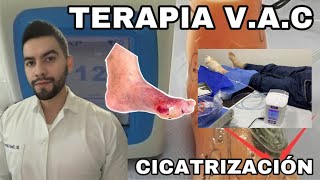 Como Funciona La Terapia V.A.C. / Terapia de cierre asistido por vacío | DR. DAVID CAMPOS