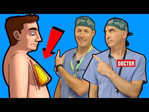 Gynecomastia (Man Boobs) - How To Get Rid Of It