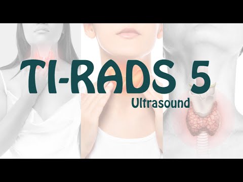 TI-RADS 5 thyroid lesion