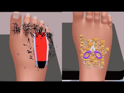 Beauty Care Game New Update Gameplay Walkthrough iOS Android - YouTube