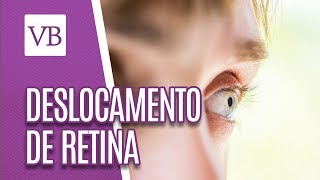 Deslocamento de Retina