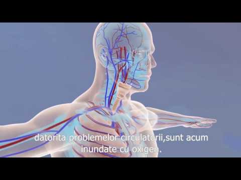 Beneficii terapie oxigen hiperbar