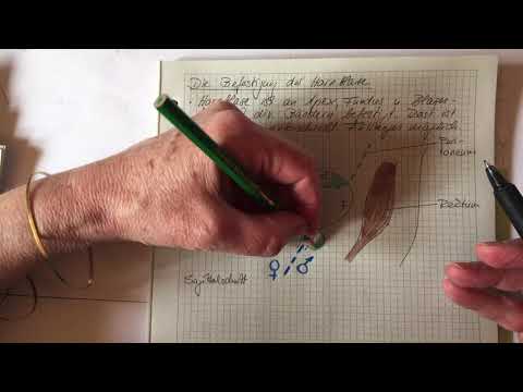 harnorg_10  Befestigung der Harnblase