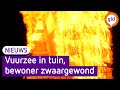 Vuurzee in achtertuin, bewoner loopt ernstige brandwonden op