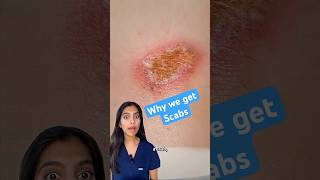 Why do we get scabs?