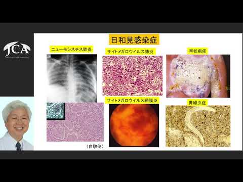 栄養学科 講演2「ウィルスが原因となる白血病と治療法」宇都宮 與（公益財団法人慈愛会今村総合病院 名誉院長兼臨床研究センター長  HTLV-1 研究センター長）