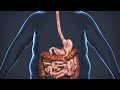 Gastric Bypass Revision Animation Grand Strand Bariatric Surgery