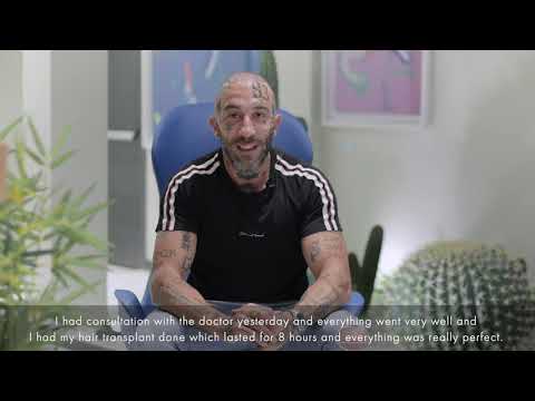 Simone Coccia trapianto capelli turchia