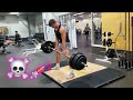 MY WORST LIFTING ACCIDENT