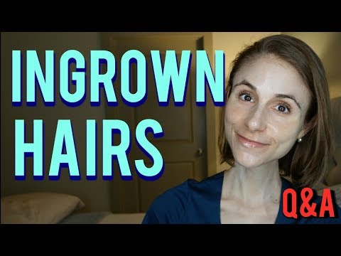 Ingrown hairs: how to get rid of them & skin care...