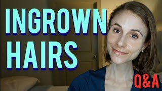 Ingrown hairs: how to get rid of them & skin care tips| Dr Dray