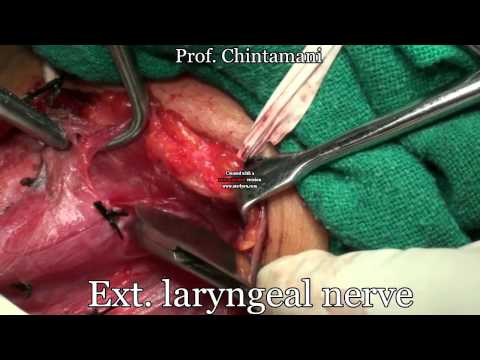 Detailed Demonstration Hemithyroidectomy