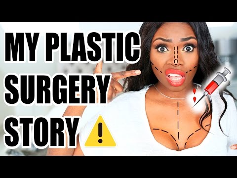 MY PLASTIC SURGERY STORY | Nose Job, Regrets, Costs, Boobs, Family and more