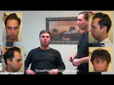 Dr. Brett Bolton Patient Rod 9 Year Follow Up Video
