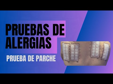 Patch test or epicutaneous allergy test