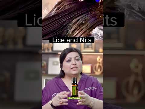 Want to Get Rid of Lice Fast? Watch This Now