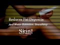 Cellulite Cream With Caffeine Dr Oz- Why He ...